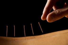 Akupunktúra – cesta za pravdou?